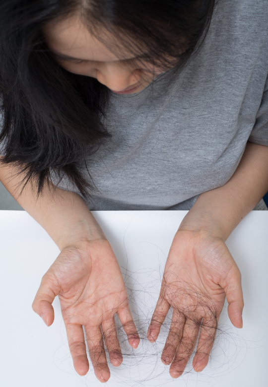 Hair Loss - You Are Not Alone